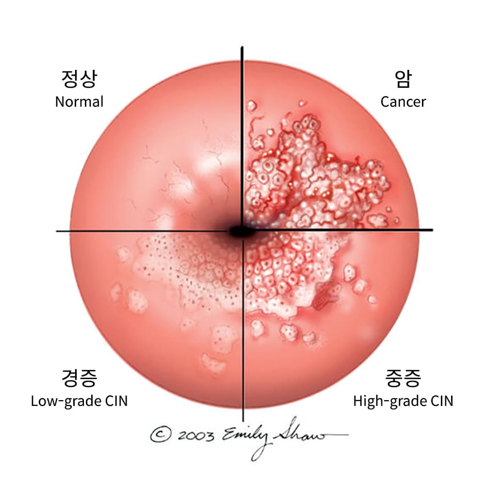 예상치 못한 진단