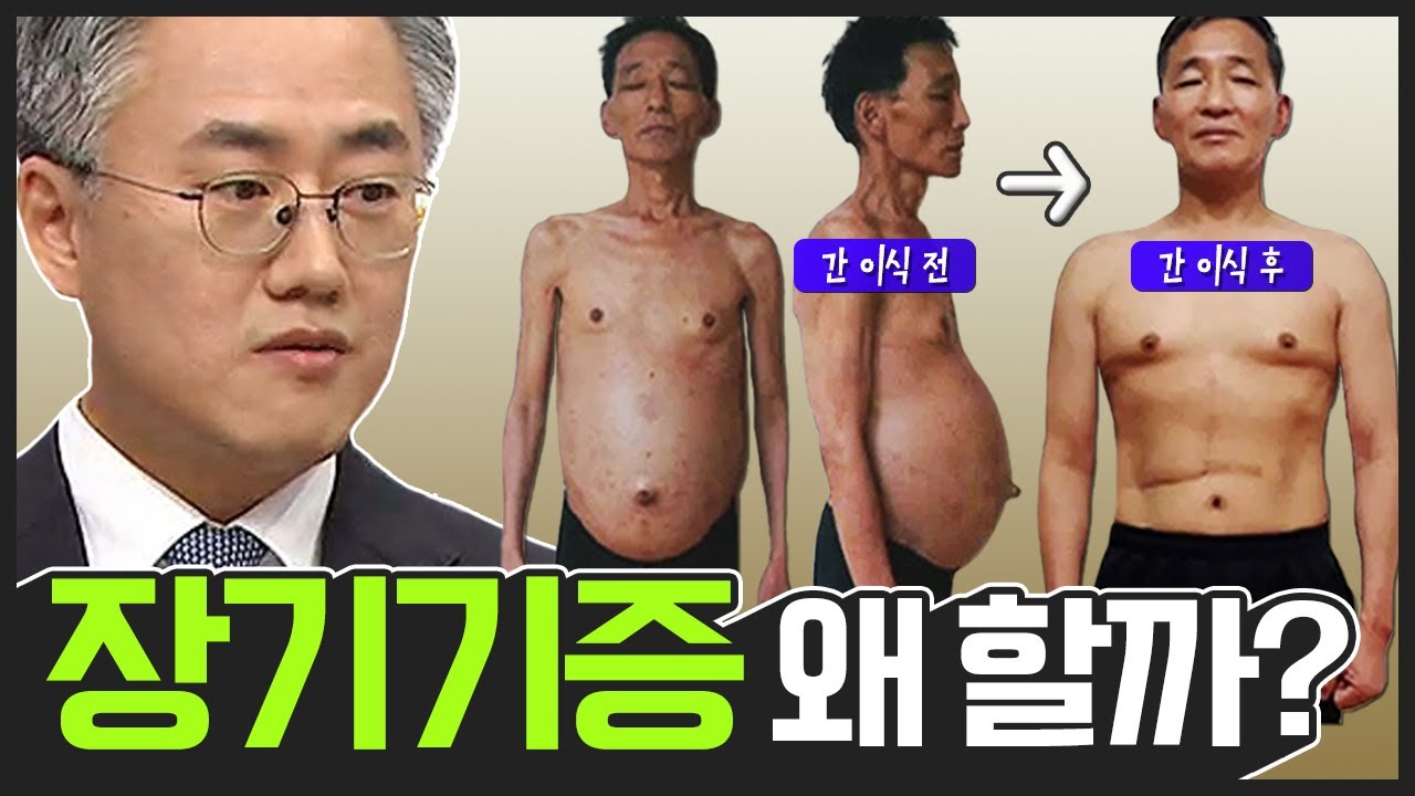 대기 일수 증가의 원인 분석