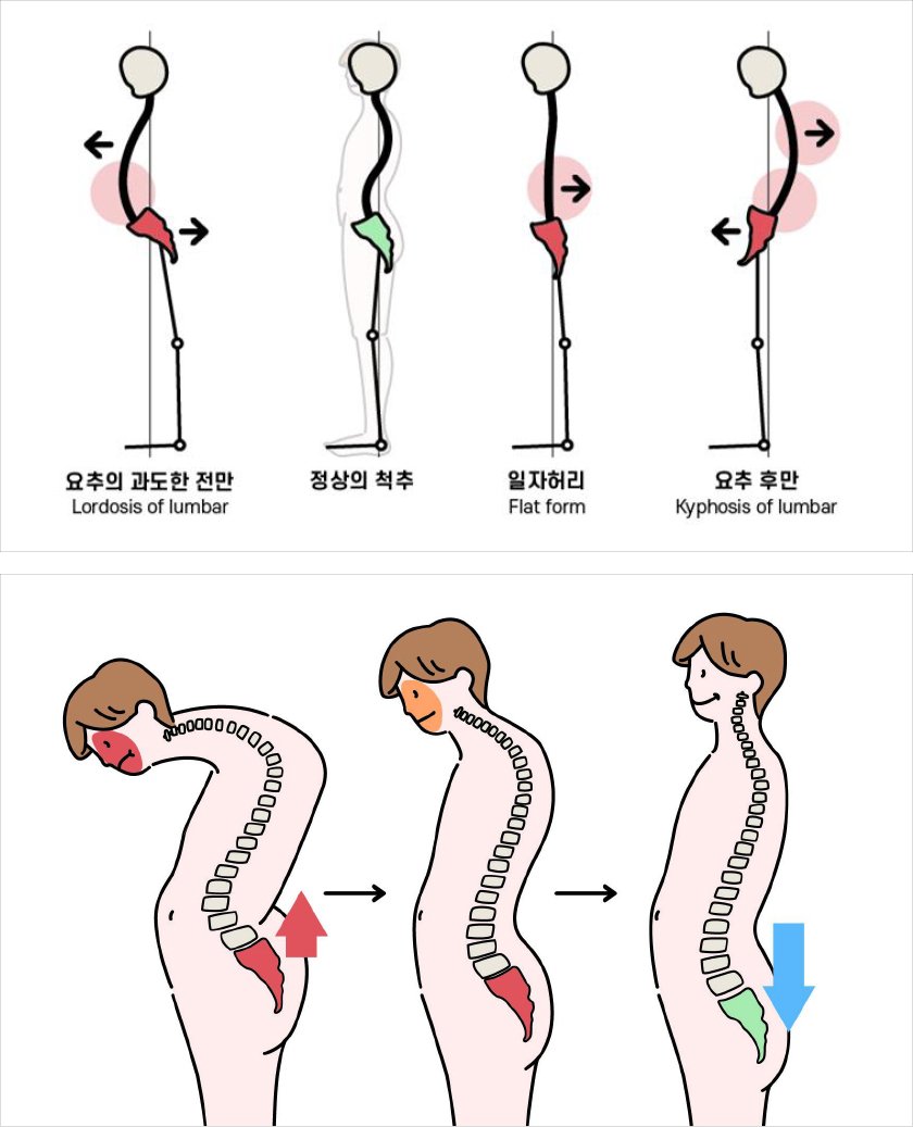 척추의 중요성과 퇴행성 변화